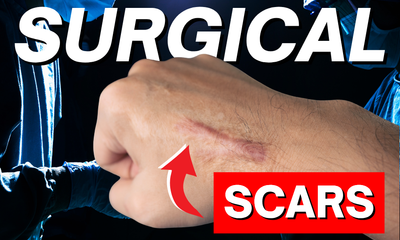 Surgical Scar Care 101: What Doctors Don’t Always Tell You