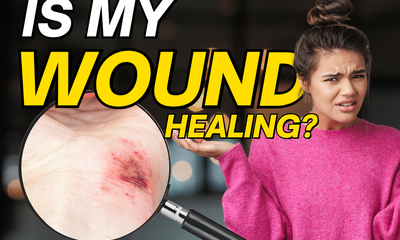 How to Tell if a Wound Is Healing Properly (Or Not)