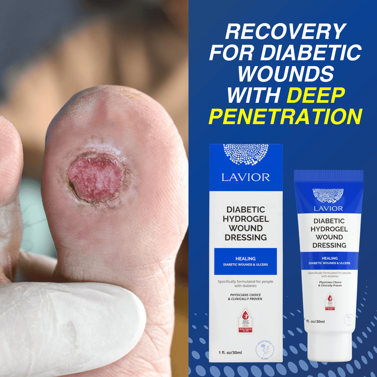 Diabetic Wound Gel - 1oz