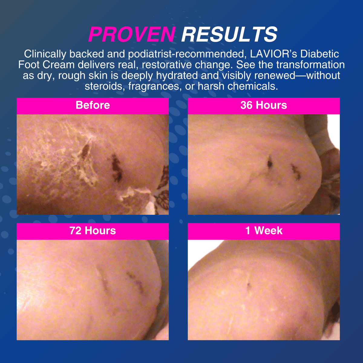 Diabetic Foot Cream - 3.4oz