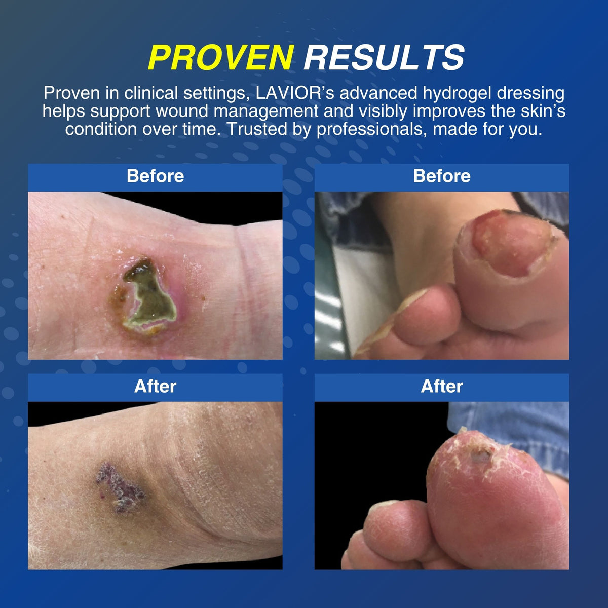 Diabetic Wound Gel - 1oz