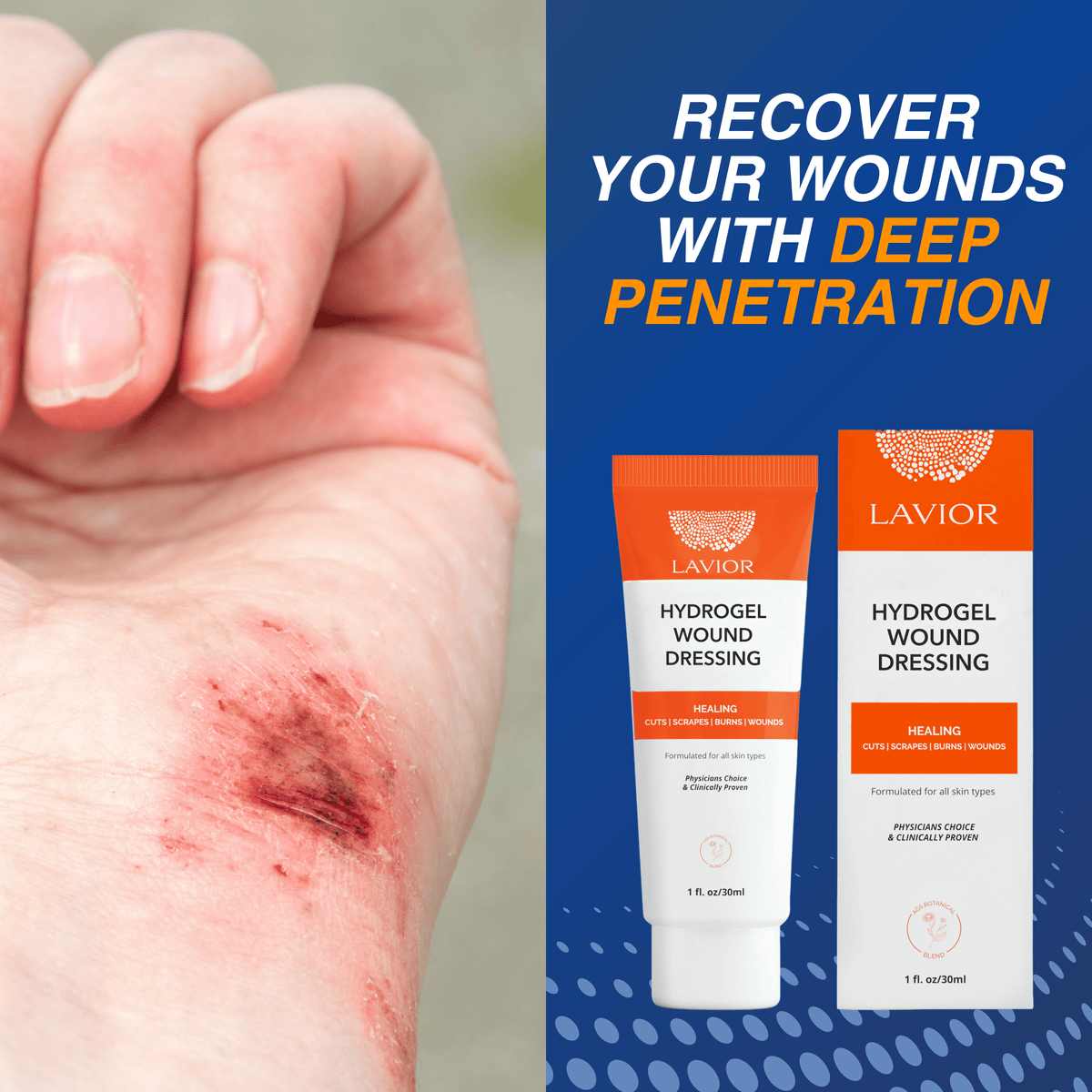Wound Care Gel - 1oz