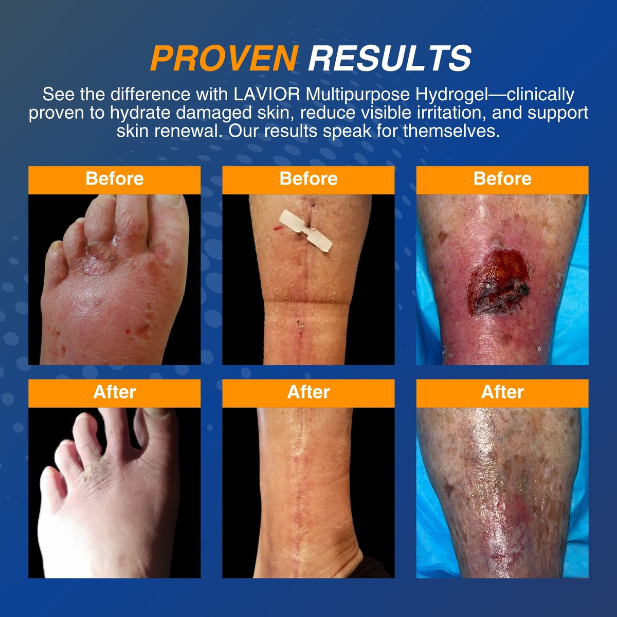 Wound Care Gel - 1oz