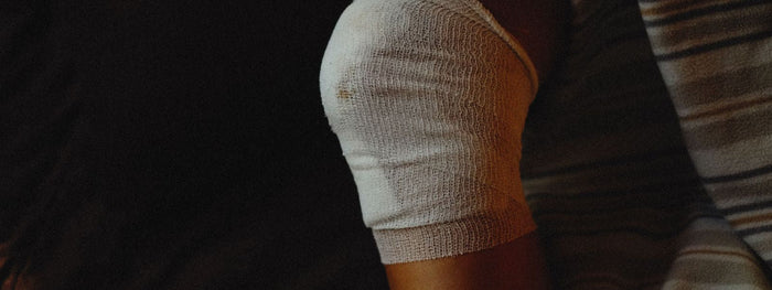 Venous Ulcers: What They Are and How to Care for Them at Home