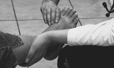 Supporting Diabetic Foot Ulcer Care: What to Know