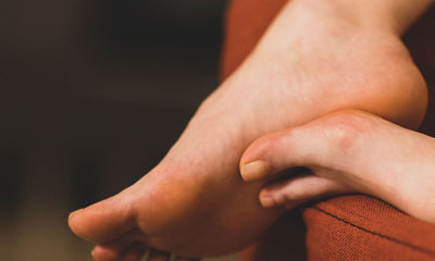 Cracked Heels: Why They Happen and How to Treat Them