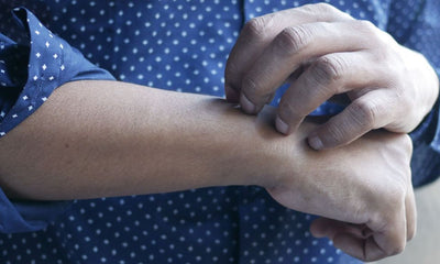 Itchy Skin and Diabetes: What's the Connection?