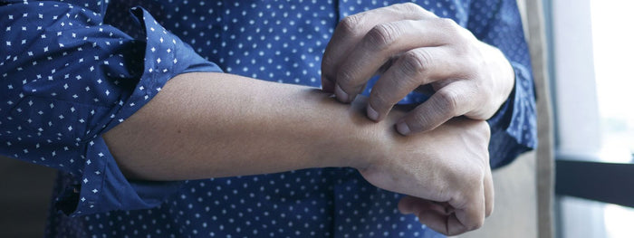 Itchy Skin and Diabetes: What's the Connection?