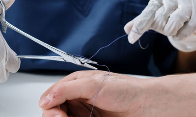 When Can I Put Lotion on My Incision? A Timeline Guide