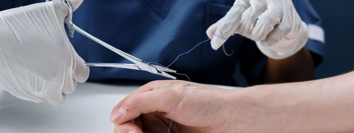 When Can I Put Lotion on My Incision? A Timeline Guide