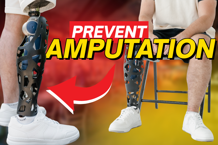 Blog thumbnail for an article on chronic wounds and amputation risk