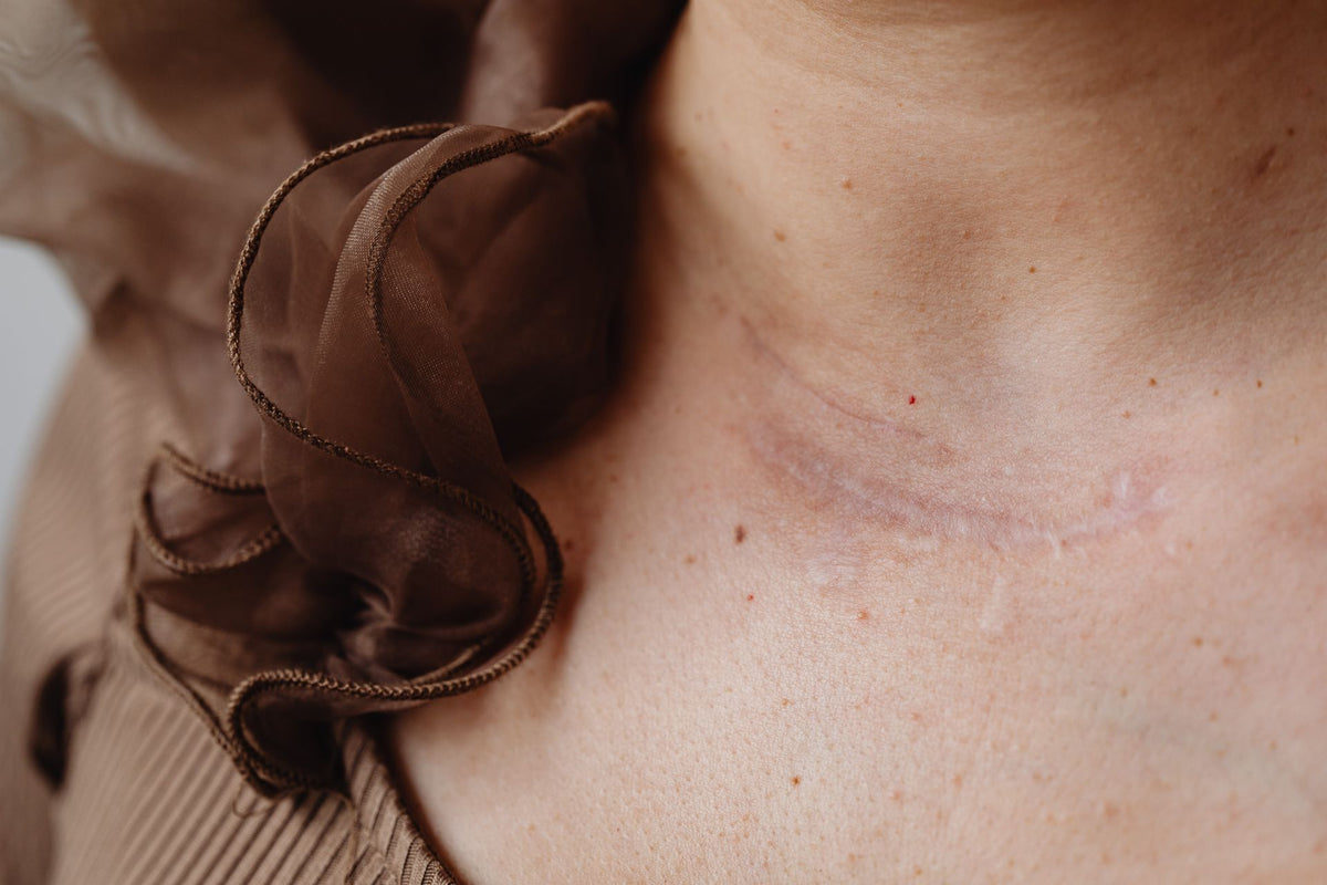 Close-up of a healing incision line on the neck