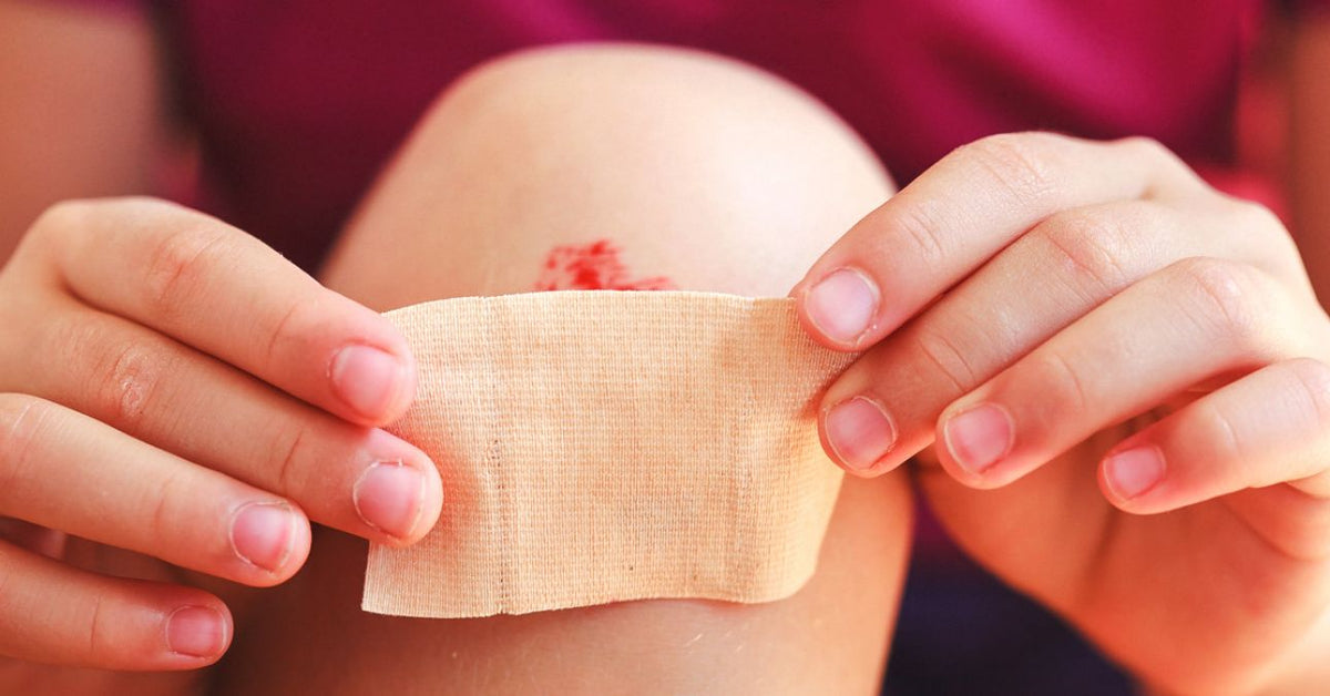 Close-up of a minor skin wound