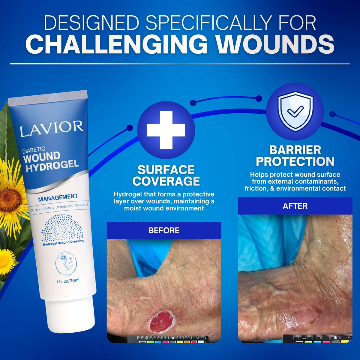Diabetic Wound Hydrogel - 1oz