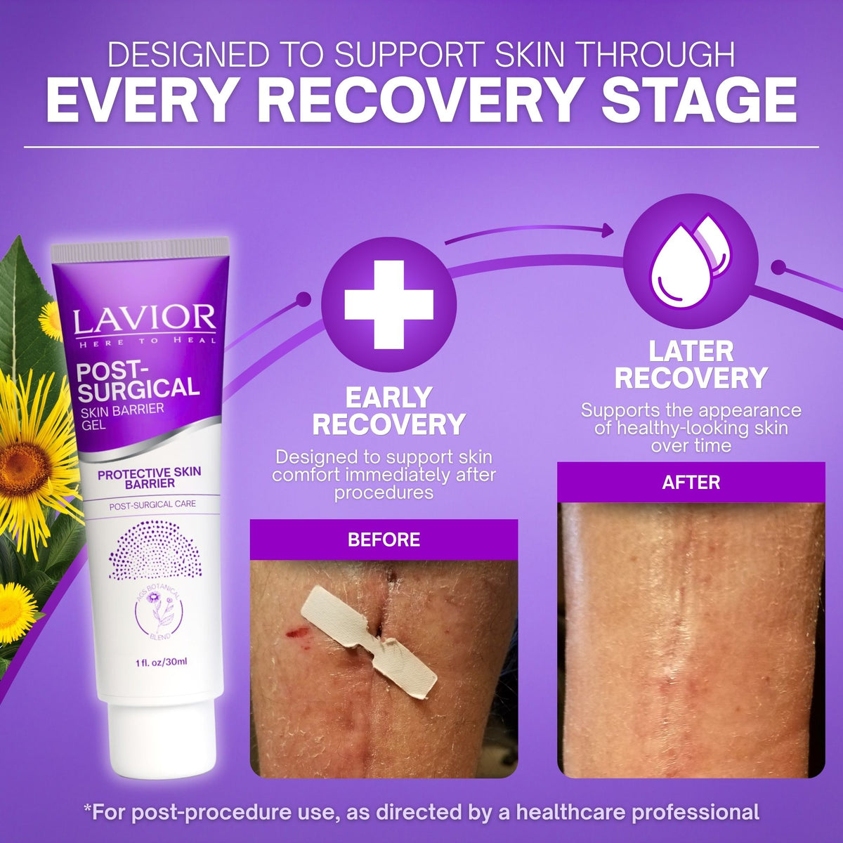 Post-Surgical Skin Barrier Gel - 1oz