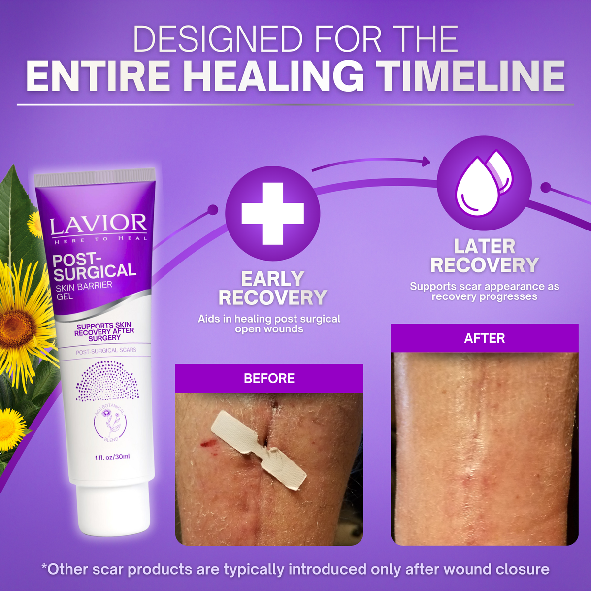 Post-Surgical Skin Barrier Gel - 1oz