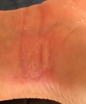 1 Week After