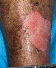 3 Weeks After
