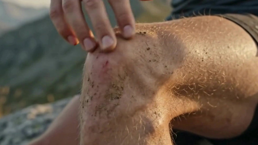 Trail runner checking a scraped knee