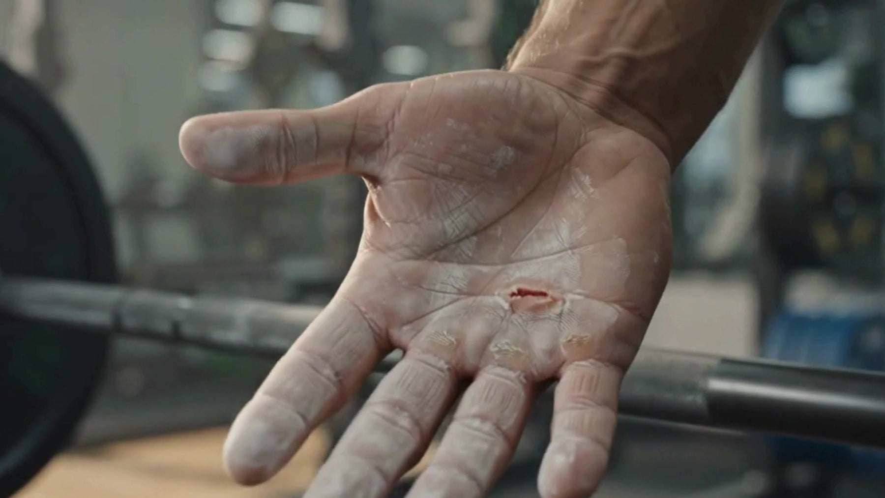 Chalked palm with a torn callus over a barbell