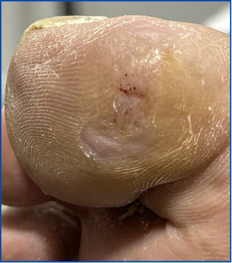 12 Days After