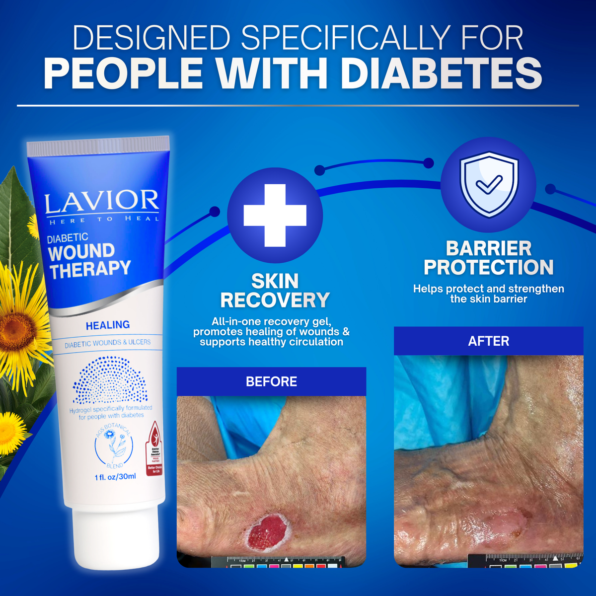Diabetic Wound Therapy Gel - 1oz