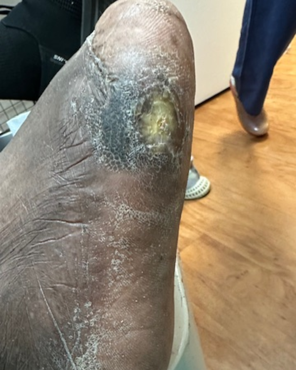 12 Days After