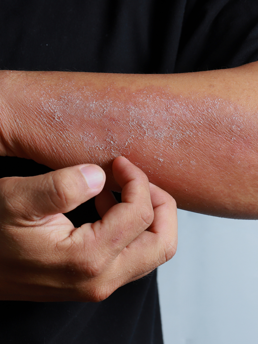 Diabetic Skin Barrier Cream